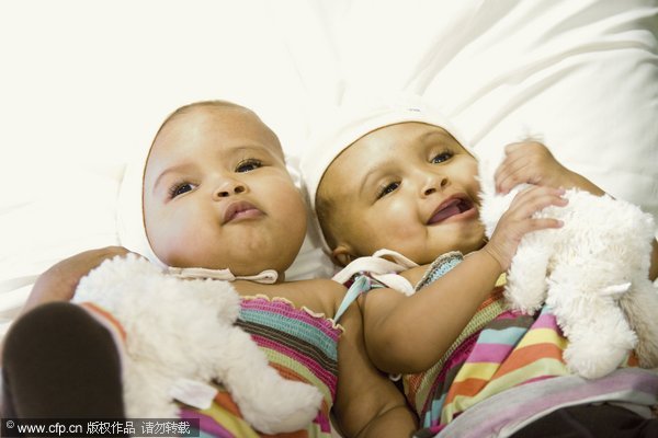 Conjoined twin girls separated