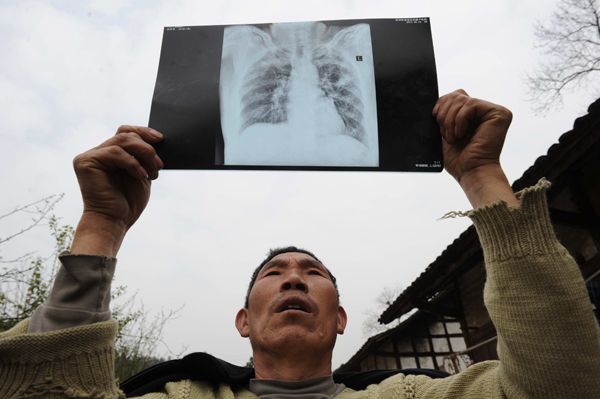 Black lung patients often face a long wait for compensation