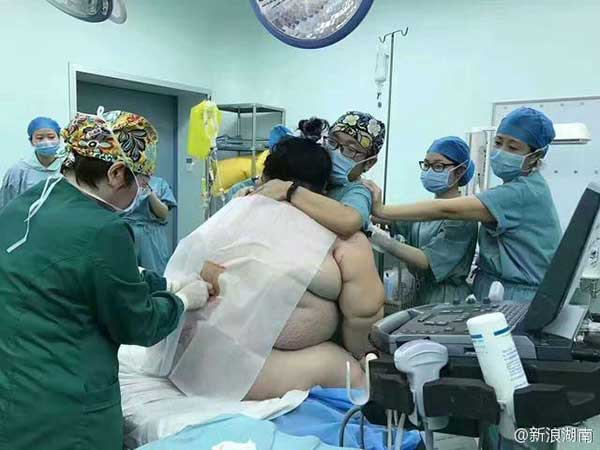 16 medical staff members help 140kg woman deliver baby