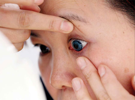 Many blind to the risks of contact lenses