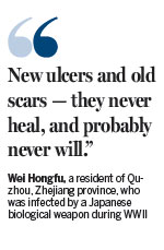 'Rotten legs': a lifetime of suffering