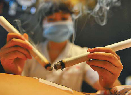 Moxibustion must improve in quality: experts