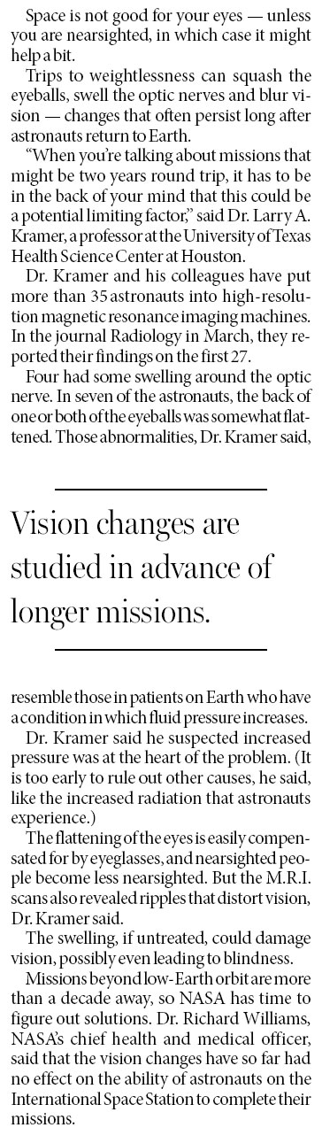 Squashed eyeballs are danger in space