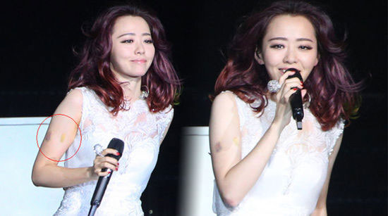 Jane Zhang Falls off Stage during Concert in Beijing