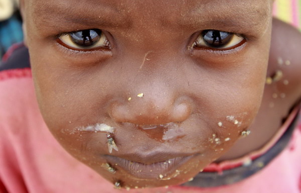 A newly arrived refugee child poses outside their tent in Baley settlement near the Ifo extension refugee camp in Dadaab, near the Kenya-Somalia border, July 27, 2011. Starving in the Horn of Africa