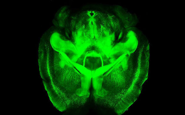 See-through brains may clear up mental riddles