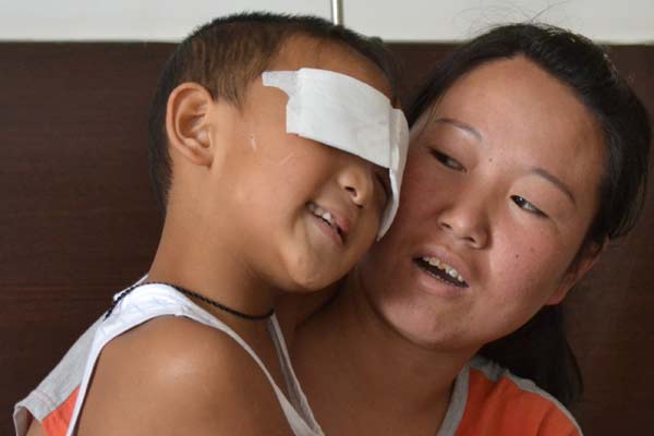 Police account of how boy lost eyes draws skepticism