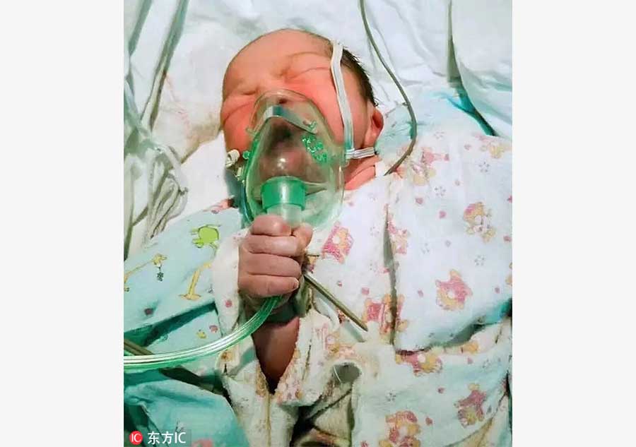 Photos of newborn holding oxygen mask go viral