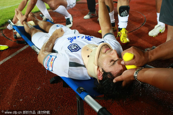 Skull fracture forces Luciano out of CSL season