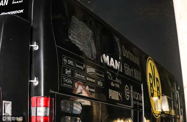 Pregame blasts rock German soccer team bus, player injured