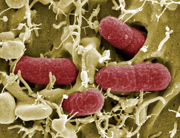 EHEC bacteria under electronic microscope