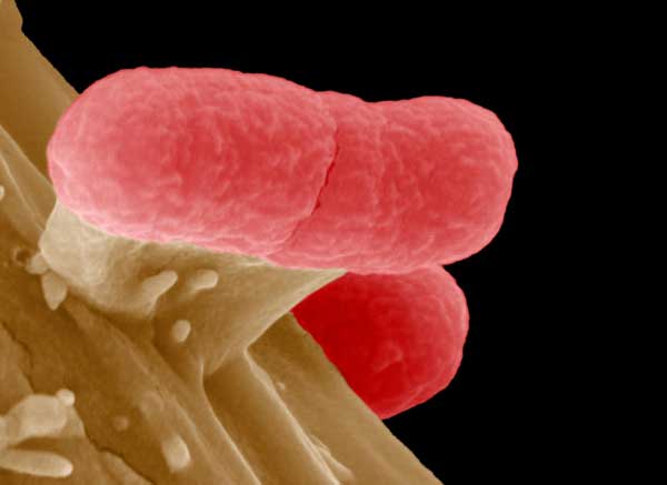EHEC bacteria under electronic microscope